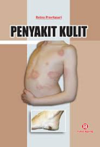 Image of Penyakit Kulit